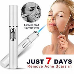 Blue Light Acne Treatment Pen