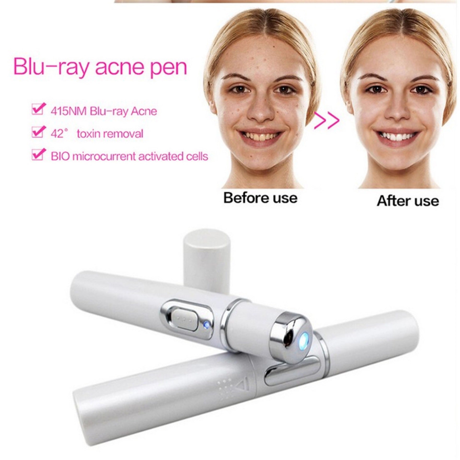 Blue Light Acne Treatment Pen
