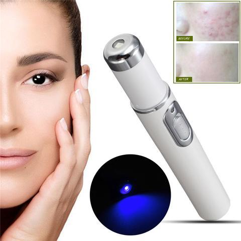 Blue Light Acne Treatment Pen