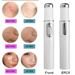 Blue Light Acne Treatment Pen